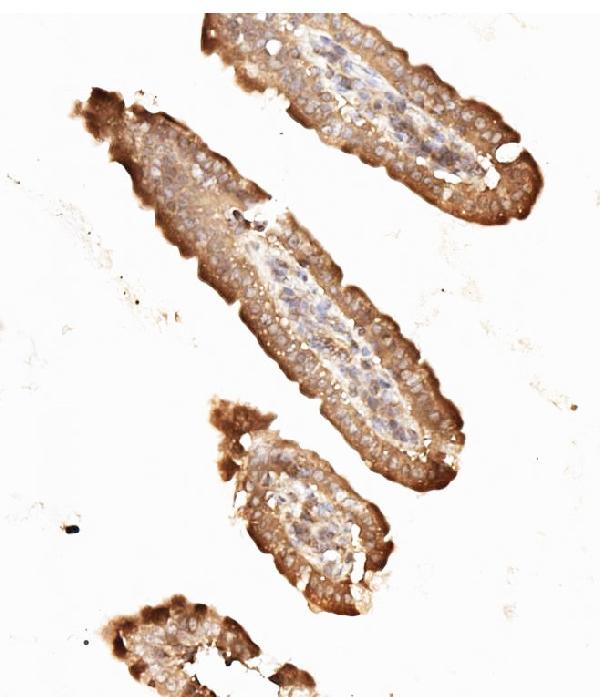 IHC analysis of NME2 using anti-NME2 antibody (PA1830). NME2 was detected in paraffin-embedded section of mouse intestine tissues. Heat mediated antigen retrieval was performed in citrate buffer (pH6, epitope retrieval solution) for 20 mins. The tissue section was blocked with 10% goat serum. The tissue section was then incubated with 1μg/ml rabbit anti-NME2 Antibody (PA1830) overnight at 4°C. Biotinylated goat anti-rabbit IgG was used as secondary antibody and incubated for 30 minutes at 37°C. The tissue section was developed using Strepavidin-Biotin-Complex (SABC)(Catalog # SA1022) with DAB as the chromogen.