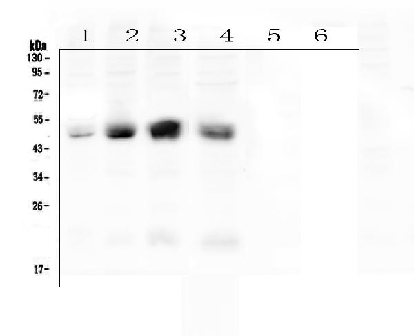 Western blot analysis of Coxsackie Adenovirus Receptor using anti-Coxsackie Adenovirus Receptor antibody (PA1852). Electrophoresis was performed on a 5-20% SDS-PAGE gel at 70V (Stacking gel) / 90V (Resolving gel) for 2-3 hours. The sample well of each lane was loaded with 50ug of sample under reducing conditions. Lane 1: human A431 whole cell lysates, Lane 2: human Hela whole cell lysates, Lane 3: human HepG2 whole cell lysates, Lane 4: human Caco-2 whole cell lysates, Lane 5: human U-937whole cell lysates(negative), Lane 6: human THP-1whole cell lysates(negative). After Electrophoresis, proteins were transferred to a Nitrocellulose membrane at 150mA for 50-90 minutes. Blocked the membrane with 5% Non-fat Milk/ TBS for 1.5 hour at RT. The membrane was incubated with rabbit anti-Coxsackie Adenovirus Receptor antigen affinity purified polyclonal antibody (Catalog # PA1852) at 0.5 μg/mL overnight at 4°C, then washed with TBS-0.1%Tween 3 times with 5 minutes each and probed with a goat anti-rabbit IgG-HRP secondary antibody at a dilution of 1:10000 for 1.5 hour at RT. The signal is developed using an Enhanced Chemiluminescent detection (ECL) kit (Catalog # EK1002) with Tanon 5200 system. A specific band was detected for Coxsackie Adenovirus Receptor at approximately 50KD. The expected band size for Coxsackie Adenovirus Receptor is at 40KD.