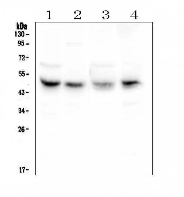 Western blot analysis of Coxsackie Adenovirus Receptor using anti-Coxsackie Adenovirus Receptor antibody (PA1852). Electrophoresis was performed on a 5-20% SDS-PAGE gel at 70V (Stacking gel) / 90V (Resolving gel) for 2-3 hours. The sample well of each lane was loaded with 50ug of sample under reducing conditions. Lane 1: rat liver tissue lysate, Lane 2: rat heart tissue lysates, Lane 3: mouse liver tissue lysates, Lane 4: mouse HEPA1-6 whole cell lysates. After Electrophoresis, proteins were transferred to a Nitrocellulose membrane at 150mA for 50-90 minutes. Blocked the membrane with 5% Non-fat Milk/ TBS for 1.5 hour at RT. The membrane was incubated with rabbit anti-Coxsackie Adenovirus Receptor antigen affinity purified polyclonal antibody (Catalog # PA1852) at 0.5 μg/mL overnight at 4°C, then washed with TBS-0.1%Tween 3 times with 5 minutes each and probed with a goat anti-rabbit IgG-HRP secondary antibody at a dilution of 1:10000 for 1.5 hour at RT. The signal is developed using an Enhanced Chemiluminescent detection (ECL) kit (Catalog # EK1002) with Tanon 5200 system. A specific band was detected for Coxsackie Adenovirus Receptor at approximately 50KD. The expected band size for Coxsackie Adenovirus Receptor is at 40KD.