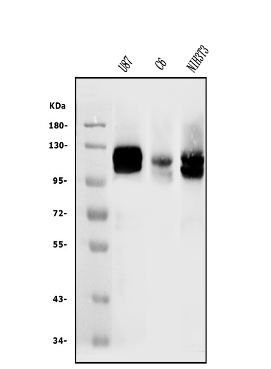 Western blot analysis of DDR2 using anti-DDR2 antibody (PA1879).