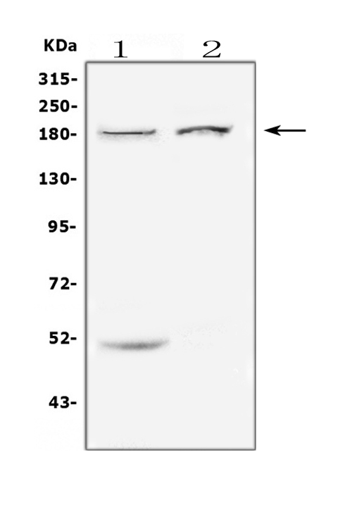 Western blot analysis of ERBB3 using anti-ERBB3 antibody (PA1880). Electrophoresis was performed on a 5-20% SDS-PAGE gel at 70V (Stacking gel) / 90V (Resolving gel) for 2-3 hours. The sample well of each lane was loaded with 50ug of sample under reducing conditions. Lane 1: human Caco-2 whole cell lysates Lane 2: human K562 whole cell lysates After Electrophoresis, proteins were transferred to a Nitrocellulose membrane at 150mA for 50-90 minutes. Blocked the membrane with 5% Non-fat Milk/ TBS for 1.5 hour at RT. The membrane was incubated with rabbit anti-ERBB3 antigen affinity purified polyclonal antibody (Catalog # PA1880) at 0.5 μg/mL overnight at 4°C, then washed with TBS-0.1%Tween 3 times with 5 minutes each and probed with a goat anti-rabbit IgG-HRP secondary antibody at a dilution of 1:10000 for 1.5 hour at RT. The signal is developed using an Enhanced Chemiluminescent detection (ECL) kit (Catalog # EK1002) with Tanon 5200 system. A specific band was detected for ERBB3 at approximately 180KD. The expected band size for ERBB3 is at 148KD.