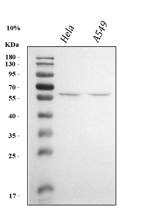 Western blot analysis of KLF5 using anti-KLF5 antibody (PA1889).