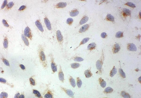 ICC analysis of SOD3 using anti-SOD3 antibody (PA1899). SOD3 was detected in immunocytochemical section of HELA cell. Enzyme antigen retrieval was performed using IHC enzyme antigen retrieval reagent (AR0022) for 15 mins. The cells were blocked with 10% goat serum. And then incubated with 1μg/ml rabbit anti-SOD3 Antibody (PA1899) overnight at 4°C. Biotinylated goat anti-rabbit IgG was used as secondary antibody and incubated for 30 minutes at 37°C. The section was developed using Strepavidin-Biotin-Complex (SABC)(Catalog # SA1022) with DAB as the chromogen.