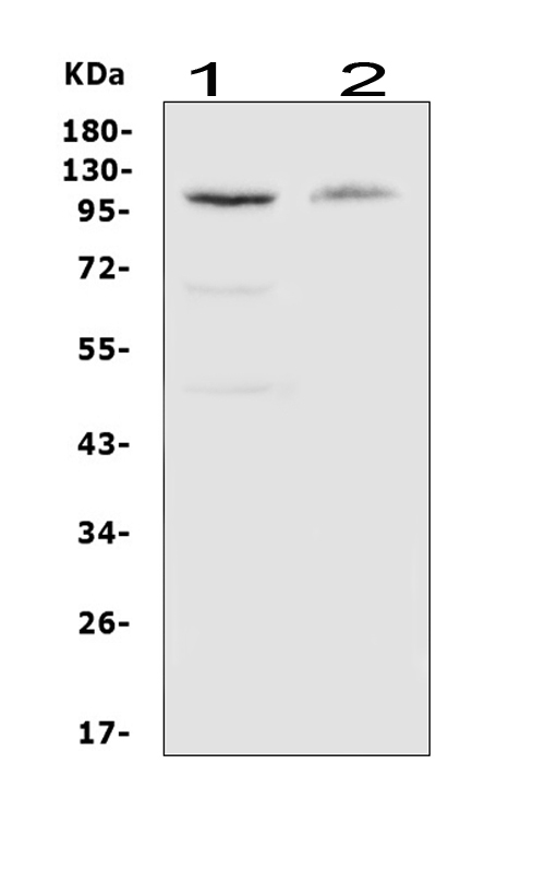 Western blot analysis of MCSF Receptor using anti-MCSF Receptor antibody (PA1905). Electrophoresis was performed on a 5-20% SDS-PAGE gel at 70V (Stacking gel) / 90V (Resolving gel) for 2-3 hours. The sample well of each lane was loaded with 50ug of sample under reducing conditions. Lane 1: human Raji whole cell lysates Lane 2: mouse RAW246.7 whole cell lysates After Electrophoresis, proteins were transferred to a Nitrocellulose membrane at 150mA for 50-90 minutes. Blocked the membrane with 5% Non-fat Milk/ TBS for 1.5 hour at RT. The membrane was incubated with rabbit anti-MCSF Receptor antigen affinity purified polyclonal antibody (Catalog # PA1905) at 0.5 μg/mL overnight at 4°C, then washed with TBS-0.1%Tween 3 times with 5 minutes each and probed with a goat anti-rabbit IgG-HRP secondary antibody at a dilution of 1:10000 for 1.5 hour at RT. The signal is developed using an Enhanced Chemiluminescent detection (ECL) kit (Catalog # EK1002) with Tanon 5200 system. A specific band was detected for MCSF Receptor at approximately 108KD. The expected band size for MCSF Receptor is at 108KD.