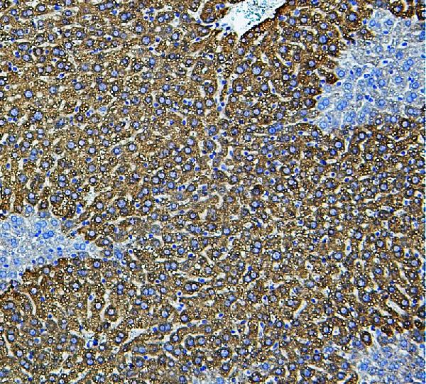 IHC analysis of CYP2E using anti-CYP2E antibody (PA1909). CYP2E was detected in paraffin-embedded section of mouse liver tissue. Heat mediated antigen retrieval was performed in citrate buffer (pH6, epitope retrieval solution) for 20 mins. The tissue section was blocked with 10% goat serum. The tissue section was then incubated with 1μg/ml rabbit anti-CYP2E Antibody (PA1909) overnight at 4°C. Biotinylated goat anti-rabbit IgG was used as secondary antibody and incubated for 30 minutes at 37°C. The tissue section was developed using Strepavidin-Biotin-Complex (SABC)(Catalog # SA1022) with DAB as the chromogen.