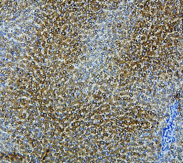 IHC analysis of CYP2E using anti-CYP2E antibody (PA1909). CYP2E was detected in paraffin-embedded section of rat liver tissue. Heat mediated antigen retrieval was performed in citrate buffer (pH6, epitope retrieval solution) for 20 mins. The tissue section was blocked with 10% goat serum. The tissue section was then incubated with 1μg/ml rabbit anti-CYP2E Antibody (PA1909) overnight at 4°C. Biotinylated goat anti-rabbit IgG was used as secondary antibody and incubated for 30 minutes at 37°C. The tissue section was developed using Strepavidin-Biotin-Complex (SABC)(Catalog # SA1022) with DAB as the chromogen.