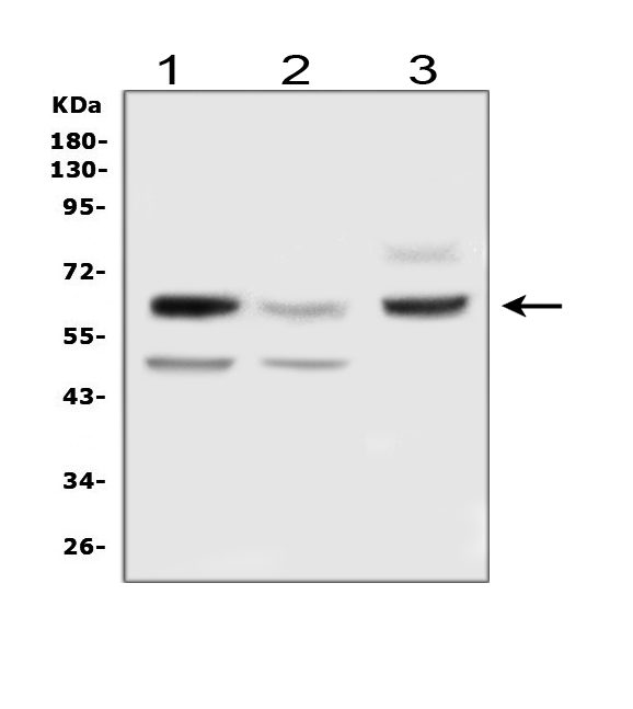 Western blot analysis of DLL3 using anti-DLL3 antibody (PA1912). Electrophoresis was performed on a 5-20% SDS-PAGE gel at 70V (Stacking gel) / 90V (Resolving gel) for 2-3 hours. The sample well of each lane was loaded with 50ug of sample under reducing conditions. Lane 1: rat brain tissue lysates Lane 2: mouse brain tissue lysates Lane 3: human HEK293 whole cell lysates After Electrophoresis, proteins were transferred to a Nitrocellulose membrane at 150mA for 50-90 minutes. Blocked the membrane with 5% Non-fat Milk/ TBS for 1.5 hour at RT. The membrane was incubated with rabbit anti-DLL3 antigen affinity purified polyclonal antibody (Catalog # PA1912) at 0.5 μg/mL overnight at 4°C, then washed with TBS-0.1%Tween 3 times with 5 minutes each and probed with a goat anti-rabbit IgG-HRP secondary antibody at a dilution of 1:10000 for 1.5 hour at RT. The signal is developed using an Enhanced Chemiluminescent detection (ECL) kit (Catalog # EK1002) with Tanon 5200 system. A specific band was detected for DLL3 at approximately 65KD. The expected band size for DLL3 is at 65KD.