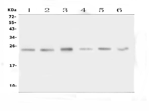 Western blot analysis of FSTL3 using anti-FSTL3 antibody (PA1915). Electrophoresis was performed on a 5-20% SDS-PAGE gel at 70V (Stacking gel) / 90V (Resolving gel) for 2-3 hours. The sample well of each lane was loaded with 50ug of sample under reducing conditions. Lane 1: rat liver tissue lysates, Lane 2: rat testis tissue lysates, Lane 3: rat NRK whole cell lysates, Lane 4: mouse liver tissue lysates, Lane 5: mouse testis tissue lysates, Lane 6: mouse lung tissue lysates. After Electrophoresis, proteins were transferred to a Nitrocellulose membrane at 150mA for 50-90 minutes. Blocked the membrane with 5% Non-fat Milk/ TBS for 1.5 hour at RT. The membrane was incubated with rabbit anti-FSTL3 antigen affinity purified polyclonal antibody (Catalog # PA1915) at 0.5 μg/mL overnight at 4°C, then washed with TBS-0.1%Tween 3 times with 5 minutes each and probed with a goat anti-rabbit IgG-HRP secondary antibody at a dilution of 1:10000 for 1.5 hour at RT. The signal is developed using an Enhanced Chemiluminescent detection (ECL) kit (Catalog # EK1002) with Tanon 5200 system. A specific band was detected for FSTL3 at approximately 22-24KD. The expected band size for FSTL3 is at 22KD.