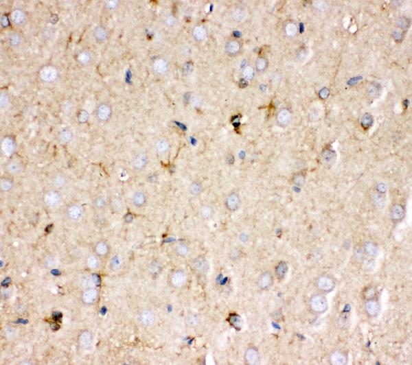 IHC analysis of Prohibitin using anti-Prohibitin antibody (PA1932). Prohibitin was detected in paraffin-embedded section of rat brain tissue. Heat mediated antigen retrieval was performed in citrate buffer (pH6, epitope retrieval solution) for 20 mins. The tissue section was blocked with 10% goat serum. The tissue section was then incubated with 1μg/ml rabbit anti-Prohibitin Antibody (PA1932) overnight at 4°C. Biotinylated goat anti-rabbit IgG was used as secondary antibody and incubated for 30 minutes at 37°C. The tissue section was developed using Strepavidin-Biotin-Complex (SABC)(Catalog # SA1022) with DAB as the chromogen.