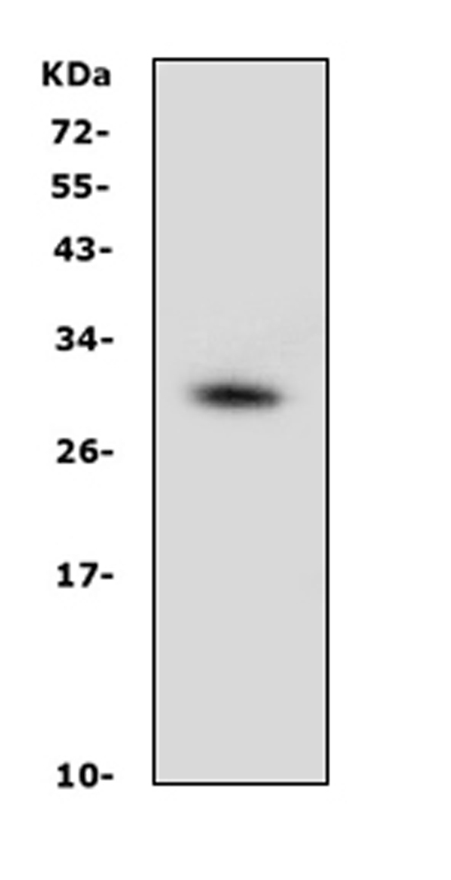 Western blot analysis of Prohibitin using anti-Prohibitin antibody (PA1932). Electrophoresis was performed on a 5-20% SDS-PAGE gel at 70V (Stacking gel) / 90V (Resolving gel) for 2-3 hours. The sample well of each lane was loaded with 50ug of sample under reducing conditions. Lane 1: mouse NIH3T3 whole cell lysate. After Electrophoresis, proteins were transferred to a Nitrocellulose membrane at 150mA for 50-90 minutes. Blocked the membrane with 5% Non-fat Milk/ TBS for 1.5 hour at RT. The membrane was incubated with rabbit anti-Prohibitin antigen affinity purified polyclonal antibody (Catalog # PA1932) at 0.5 μg/mL overnight at 4°C, then washed with TBS-0.1%Tween 3 times with 5 minutes each and probed with a goat anti-rabbit IgG-HRP secondary antibody at a dilution of 1:10000 for 1.5 hour at RT. The signal is developed using an Enhanced Chemiluminescent detection (ECL) kit (Catalog # EK1002) with Tanon 5200 system. A specific band was detected for Prohibitin at approximately 30KD. The expected band size for Prohibitin is at 30KD.