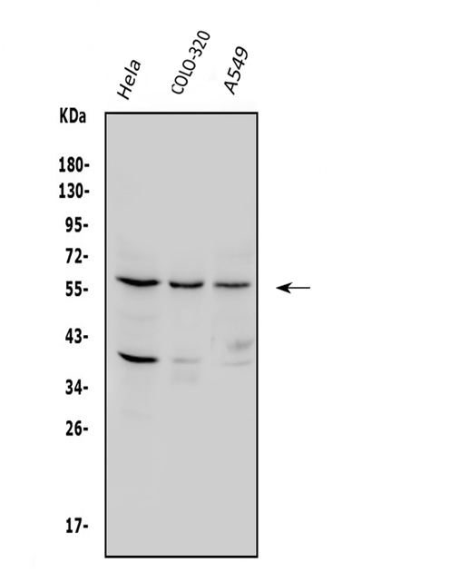 Western blot analysis of SQSTM1 using anti-SQSTM1 antibody (PA1955).