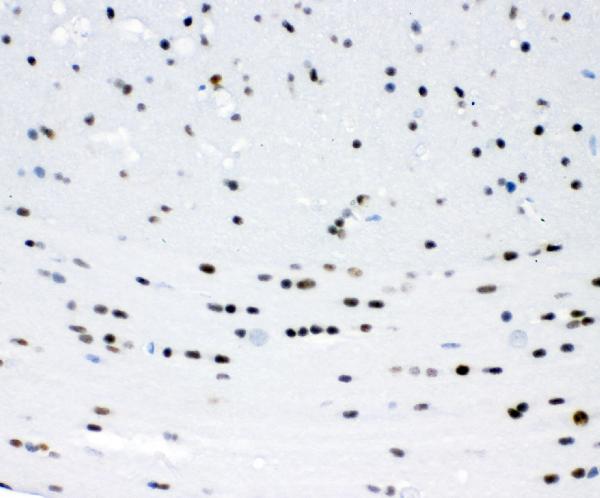 IHC analysis of ZEB2 using anti-ZEB2 antibody (PA1959). ZEB2 was detected in paraffin-embedded section of mouse brain tissue. Heat mediated antigen retrieval was performed in citrate buffer (pH6, epitope retrieval solution) for 20 mins. The tissue section was blocked with 10% goat serum. The tissue section was then incubated with 1μg/ml rabbit anti-ZEB2 Antibody (PA1959) overnight at 4°C. Biotinylated goat anti-rabbit IgG was used as secondary antibody and incubated for 30 minutes at 37°C. The tissue section was developed using Strepavidin-Biotin-Complex (SABC)(Catalog # SA1022) with DAB as the chromogen.