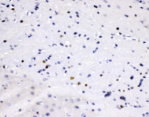 IHC analysis of ZEB2 using anti-ZEB2 antibody (PA1959). ZEB2 was detected in paraffin-embedded section of rat brain tissue. Heat mediated antigen retrieval was performed in citrate buffer (pH6, epitope retrieval solution) for 20 mins. The tissue section was blocked with 10% goat serum. The tissue section was then incubated with 1μg/ml rabbit anti-ZEB2 Antibody (PA1959) overnight at 4°C. Biotinylated goat anti-rabbit IgG was used as secondary antibody and incubated for 30 minutes at 37°C. The tissue section was developed using Strepavidin-Biotin-Complex (SABC)(Catalog # SA1022) with DAB as the chromogen.