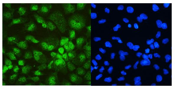 IF analysis of DDX5 using anti-DDX5 antibody (PA1964). DDX5 was detected in immunocytochemical section of A431 cell. Enzyme antigen retrieval was performed using IHC enzyme antigen retrieval reagent (AR0022) for 15 mins. The cells were blocked with 10% goat serum. And then incubated with 2μg/mL rabbit anti-DDX5 Antibody (PA1964) overnight at 4°C. DyLight®488 Conjugated Goat Anti-Rabbit IgG (BA1127) was used as secondary antibody at 1:100 dilution and incubated for 30 minutes at 37°C. The section was counterstained with DAPI. Visualize using a fluorescence microscope and filter sets appropriate for the label used.