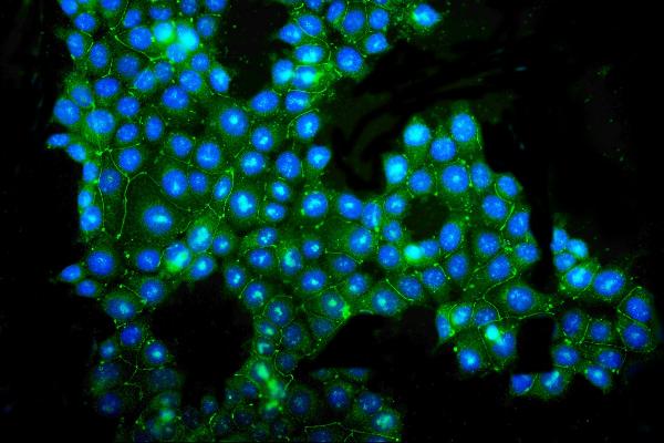 IF analysis of TJP3 using anti-TJP3 antibody (PA1972).