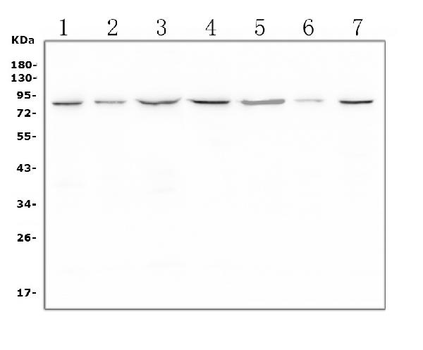 Western blot analysis of LTK using anti-LTK antibody (PA1990). Electrophoresis was performed on a 5-20% SDS-PAGE gel at 70V (Stacking gel) / 90V (Resolving gel) for 2-3 hours. The sample well of each lane was loaded with 50ug of sample under reducing conditions. Lane 1: human THP-1 whole cell lysates Lane 2: human Caco-2 whole cell lysates Lane 3: human K562 whole cell lysates Lane 4: human Jurkat whole cell lysates Lane 5: human MDA-MB-453 whole cell lysates Lane 6: human U2OS whole cell lysates Lane 7: human PC-3 whole cell lysates After Electrophoresis, proteins were transferred to a Nitrocellulose membrane at 150mA for 50-90 minutes. Blocked the membrane with 5% Non-fat Milk/ TBS for 1.5 hour at RT. The membrane was incubated with rabbit anti-LTK antigen affinity purified polyclonal antibody (Catalog # PA1990) at 0.5 μg/mL overnight at 4°C, then washed with TBS-0.1%Tween 3 times with 5 minutes each and probed with a goat anti-rabbit IgG-HRP secondary antibody at a dilution of 1:10000 for 1.5 hour at RT. The signal is developed using an Enhanced Chemiluminescent detection (ECL) kit (Catalog # EK1002) with Tanon 5200 system. A specific band was detected for LTK at approximately 85-91KD. The expected band size for LTK is at 91KD.