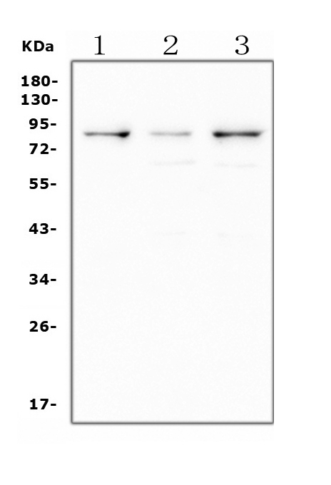 Western blot analysis of LTK using anti-LTK antibody (PA1990). Electrophoresis was performed on a 5-20% SDS-PAGE gel at 70V (Stacking gel) / 90V (Resolving gel) for 2-3 hours. The sample well of each lane was loaded with 50ug of sample under reducing conditions. Lane 1: rat thymus tissue lysates Lane 2: rat brain tissue lysates Lane 3: mouse brain tissue lysates After Electrophoresis, proteins were transferred to a Nitrocellulose membrane at 150mA for 50-90 minutes. Blocked the membrane with 5% Non-fat Milk/ TBS for 1.5 hour at RT. The membrane was incubated with rabbit anti-LTK antigen affinity purified polyclonal antibody (Catalog # PA1990) at 0.5 μg/mL overnight at 4°C, then washed with TBS-0.1%Tween 3 times with 5 minutes each and probed with a goat anti-rabbit IgG-HRP secondary antibody at a dilution of 1:10000 for 1.5 hour at RT. The signal is developed using an Enhanced Chemiluminescent detection (ECL) kit (Catalog # EK1002) with Tanon 5200 system. A specific band was detected for LTK at approximately 85-91KD. The expected band size for LTK is at 91KD.