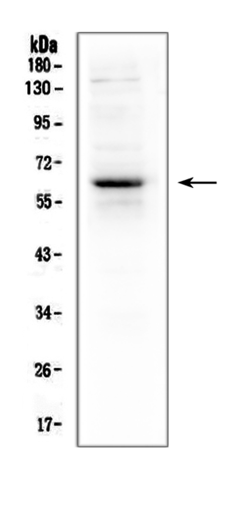 Western blot analysis of T-bet using anti-T-bet antibody (PA1999). Electrophoresis was performed on a 5-20% SDS-PAGE gel at 70V (Stacking gel) / 90V (Resolving gel) for 2-3 hours. The sample well of each lane was loaded with 50ug of sample under reducing conditions. Lane 1: mouse thymus tissue lysate. After Electrophoresis, proteins were transferred to a Nitrocellulose membrane at 150mA for 50-90 minutes. Blocked the membrane with 5% Non-fat Milk/ TBS for 1.5 hour at RT. The membrane was incubated with rabbit anti-T-bet antigen affinity purified polyclonal antibody (Catalog # PA1999) at 0.5 μg/mL overnight at 4°C, then washed with TBS-0.1%Tween 3 times with 5 minutes each and probed with a goat anti-rabbit IgG-HRP secondary antibody at a dilution of 1:10000 for 1.5 hour at RT. The signal is developed using an Enhanced Chemiluminescent detection (ECL) kit (Catalog # EK1002) with Tanon 5200 system. A specific band was detected for T-bet at approximately 58-60KD. The expected band size for T-bet is at 58KD.