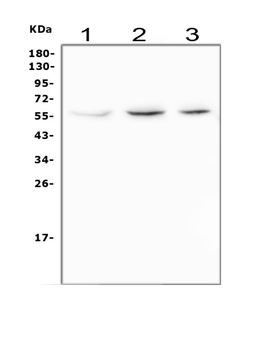 Western blot analysis of TRAF2 using anti-TRAF2 antibody (PA2007). Electrophoresis was performed on a 5-20% SDS-PAGE gel at 70V (Stacking gel) / 90V (Resolving gel) for 2-3 hours. The sample well of each lane was loaded with 50ug of sample under reducing conditions. Lane 1: human Raji whole cell lysate, Lane 2: rat PC-12 whole cell lysate, Lane 3: mouse spleen tissue lysate. After Electrophoresis, proteins were transferred to a Nitrocellulose membrane at 150mA for 50-90 minutes. Blocked the membrane with 5% Non-fat Milk/ TBS for 1.5 hour at RT. The membrane was incubated with rabbit anti-TRAF2 antigen affinity purified polyclonal antibody (Catalog # PA2007) at 0.5 μg/mL overnight at 4°C, then washed with TBS-0.1%Tween 3 times with 5 minutes each and probed with a goat anti-rabbit IgG-HRP secondary antibody at a dilution of 1:10000 for 1.5 hour at RT. The signal is developed using an Enhanced Chemiluminescent detection (ECL) kit (Catalog # EK1002) with Tanon 5200 system. A specific band was detected for TRAF2 at approximately 56KD. The expected band size for TRAF2 is at 56KD.