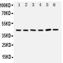 Anti-TRAM1 antibody, PA2010,WB, Lane 1: Rat Brain Tissue Lysate Lane 2: Rat Kidney Tissue Lysate Lane 3: 293T Cell Lysate Lane 4: RAJI Cell Lysate Lane 5: JURKAT Cell Lysate Lane 6: Hela Cell Lysate