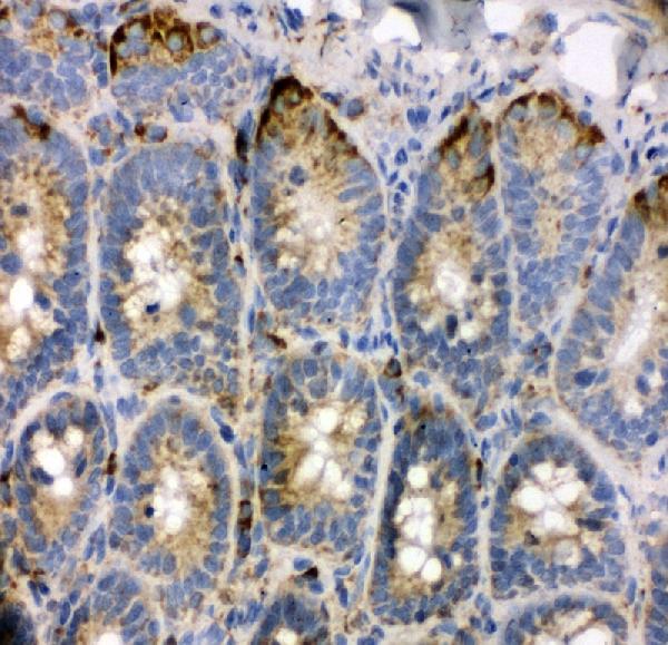 IHC analysis of TRAM1 using anti-TRAM1 antibody (PA2010). TRAM1 was detected in frozen section of rat intestine tissues. The tissue section was blocked with 10% goat serum. The tissue section was then incubated with 1μg/ml rabbit anti-TRAM1 Antibody (PA2010) overnight at 4°C. Biotinylated goat anti-rabbit IgG was used as secondary antibody and incubated for 30 minutes at 37°C. The tissue section was developed using Strepavidin-Biotin-Complex (SABC)(Catalog # SA1022) with DAB as the chromogen.