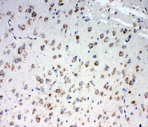 IHC analysis of TRAM1 using anti-TRAM1 antibody (PA2010). TRAM1 was detected in frozen section of rat brain tissues. The tissue section was blocked with 10% goat serum. The tissue section was then incubated with 1μg/ml rabbit anti-TRAM1 Antibody (PA2010) overnight at 4°C. Biotinylated goat anti-rabbit IgG was used as secondary antibody and incubated for 30 minutes at 37°C. The tissue section was developed using Strepavidin-Biotin-Complex (SABC)(Catalog # SA1022) with DAB as the chromogen.