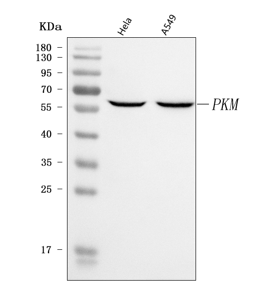 Western blot analysis of PKM2 using anti-PKM2 antibody (PA2046).