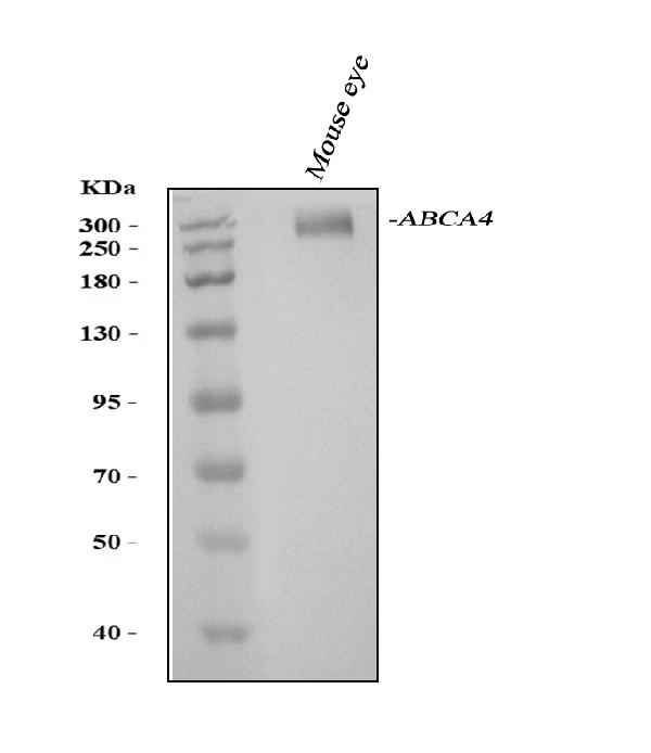 Western blot analysis of ABCA4 using anti-ABCA4 antibody (PA2066).