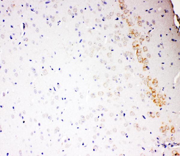 IHC analysis of ALDH2 using anti-ALDH2 antibody (PA2073). ALDH2 was detected in paraffin-embedded section of rat brain tissues. Heat mediated antigen retrieval was performed in citrate buffer (pH6, epitope retrieval solution) for 20 mins. The tissue section was blocked with 10% goat serum. The tissue section was then incubated with 1μg/ml rabbit anti-ALDH2 Antibody (PA2073) overnight at 4°C. Biotinylated goat anti-rabbit IgG was used as secondary antibody and incubated for 30 minutes at 37°C. The tissue section was developed using Strepavidin-Biotin-Complex (SABC)(Catalog # SA1022) with DAB as the chromogen.