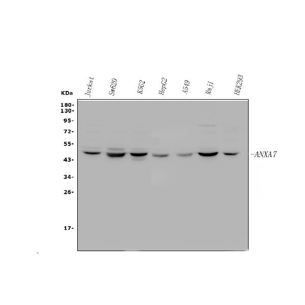 Western blot analysis of ANXA7 using anti-ANXA7 antibody (PA2076).