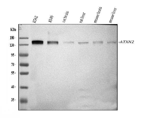 Western blot analysis of ATXN2 using anti-ATXN2 antibody (PA2098).