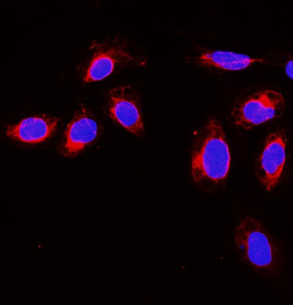 IF analysis of Gelsolin using anti-Gelsolin antibody (PA2109).