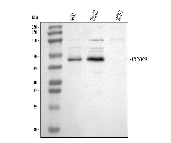 Western blot analysis of PCSK9 using anti-PCSK9 antibody (PA2130).