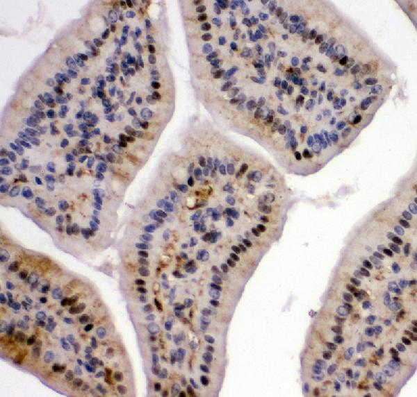 IHC analysis of VCP using anti-VCP antibody (PA2137). VCP was detected in paraffin-embedded section of mouse intestine tissue. Heat mediated antigen retrieval was performed in citrate buffer (pH6, epitope retrieval solution) for 20 mins. The tissue section was blocked with 10% goat serum. The tissue section was then incubated with 1μg/ml rabbit anti-VCP Antibody (PA2137) overnight at 4°C. Biotinylated goat anti-rabbit IgG was used as secondary antibody and incubated for 30 minutes at 37°C. The tissue section was developed using Strepavidin-Biotin-Complex (SABC)(Catalog # SA1022) with DAB as the chromogen.