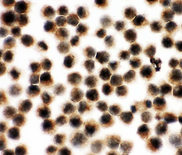 ICC analysis of VCP using anti-VCP antibody (PA2137). VCP was detected in immunocytochemical section of K562 cell. Enzyme antigen retrieval was performed using IHC enzyme antigen retrieval reagent (AR0022) for 15 mins. The cells were blocked with 10% goat serum. And then incubated with 1μg/ml rabbit anti-VCP Antibody (PA2137) overnight at 4°C. Biotinylated goat anti-rabbit IgG was used as secondary antibody and incubated for 30 minutes at 37°C. The section was developed using Strepavidin-Biotin-Complex (SABC)(Catalog # SA1022) with DAB as the chromogen.