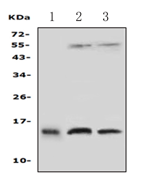 Western blot analysis of PFN2 using anti-PFN2 antibody (PA2162). Electrophoresis was performed on a 5-20% SDS-PAGE gel at 70V (Stacking gel) / 90V (Resolving gel) for 2-3 hours. The sample well of each lane was loaded with 50ug of sample under reducing conditions. Lane 1: human placenta tissue lysates, Lane 2: rat brain tissue lysates, Lane 3: mouse brain tissue lysates, After Electrophoresis, proteins were transferred to a Nitrocellulose membrane at 150mA for 50-90 minutes. Blocked the membrane with 5% Non-fat Milk/ TBS for 1.5 hour at RT. The membrane was incubated with rabbit anti-PFN2 antigen affinity purified polyclonal antibody (Catalog # PA2162) at 0.5 μg/mL overnight at 4°C, then washed with TBS-0.1%Tween 3 times with 5 minutes each and probed with a goat anti-rabbit IgG-HRP secondary antibody at a dilution of 1:10000 for 1.5 hour at RT. The signal is developed using an Enhanced Chemiluminescent detection (ECL) kit (Catalog # EK1002) with Tanon 5200 system. A specific band was detected for PFN2 at approximately 15KD. The expected band size for PFN2 is at 15KD.
