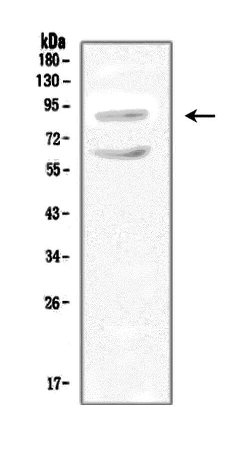 Western blot analysis of SLC9A2 using anti-SLC9A2 antibody (PA2219). Electrophoresis was performed on a 5-20% SDS-PAGE gel at 70V (Stacking gel) / 90V (Resolving gel) for 2-3 hours. The sample well of each lane was loaded with 50ug of sample under reducing conditions. Lane 1: rat kidney tissue lysate. After Electrophoresis, proteins were transferred to a Nitrocellulose membrane at 150mA for 50-90 minutes. Blocked the membrane with 5% Non-fat Milk/ TBS for 1.5 hour at RT. The membrane was incubated with rabbit anti-SLC9A2 antigen affinity purified polyclonal antibody (Catalog # PA2219) at 0.5 μg/mL overnight at 4°C, then washed with TBS-0.1%Tween 3 times with 5 minutes each and probed with a goat anti-rabbit IgG-HRP secondary antibody at a dilution of 1:10000 for 1.5 hour at RT. The signal is developed using an Enhanced Chemiluminescent detection (ECL) kit (Catalog # EK1002) with Tanon 5200 system. A specific band was detected for SLC9A2 at approximately 91KD. The expected band size for SLC9A2 is at 91KD.