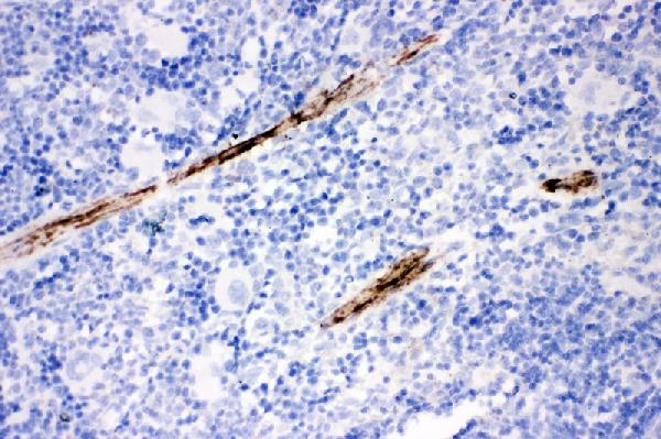 IHC analysis of Calponin using anti-Calponin antibody (PA2224). Calponin was detected in paraffin-embedded section of mouse spleen tissue. Heat mediated antigen retrieval was performed in citrate buffer (pH6, epitope retrieval solution) for 20 mins. The tissue section was blocked with 10% goat serum. The tissue section was then incubated with 1μg/ml rabbit anti-Calponin Antibody (PA2224) overnight at 4°C. Biotinylated goat anti-rabbit IgG was used as secondary antibody and incubated for 30 minutes at 37°C. The tissue section was developed using Strepavidin-Biotin-Complex (SABC)(Catalog # SA1022) with DAB as the chromogen.