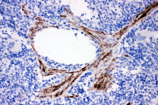 IHC analysis of Calponin using anti-Calponin antibody (PA2224). Calponin was detected in paraffin-embedded section of rat spleen tissue. Heat mediated antigen retrieval was performed in citrate buffer (pH6, epitope retrieval solution) for 20 mins. The tissue section was blocked with 10% goat serum. The tissue section was then incubated with 1μg/ml rabbit anti-Calponin Antibody (PA2224) overnight at 4°C. Biotinylated goat anti-rabbit IgG was used as secondary antibody and incubated for 30 minutes at 37°C. The tissue section was developed using Strepavidin-Biotin-Complex (SABC)(Catalog # SA1022) with DAB as the chromogen.