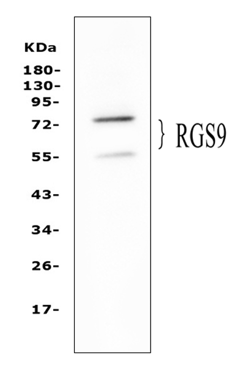 Western blot analysis of RGS9 using anti-RGS9 antibody (PA2241). Electrophoresis was performed on a 5-20% SDS-PAGE gel at 70V (Stacking gel) / 90V (Resolving gel) for 2-3 hours. The sample well of each lane was loaded with 50ug of sample under reducing conditions. Lane 1: human PANC-1 whole cell lysate. After Electrophoresis, proteins were transferred to a Nitrocellulose membrane at 150mA for 50-90 minutes. Blocked the membrane with 5% Non-fat Milk/ TBS for 1.5 hour at RT. The membrane was incubated with rabbit anti-RGS9 antigen affinity purified polyclonal antibody (Catalog # PA2241) at 0.5 μg/mL overnight at 4°C, then washed with TBS-0.1%Tween 3 times with 5 minutes each and probed with a goat anti-rabbit IgG-HRP secondary antibody at a dilution of 1:10000 for 1.5 hour at RT. The signal is developed using an Enhanced Chemiluminescent detection (ECL) kit (Catalog # EK1002) with Tanon 5200 system. Specific bands were detected for RGS9 at approximately 56, 77KD. The expected band size for RGS9 is at 77KD.