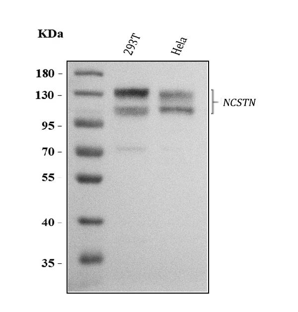 Western blot analysis of NCSTN using anti-NCSTN antibody (PA2250).