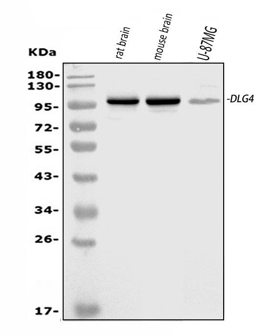 Western blot analysis of PSD95/DLG4 using anti-PSD95/DLG4 antibody (PA2295).