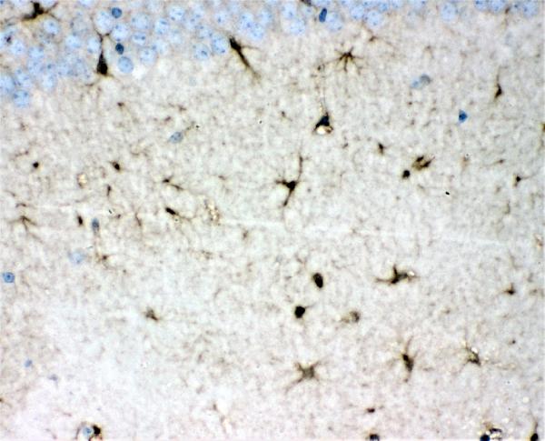 IHC analysis of DDAH1 using anti-DDAH1 antibody (PB10000). DDAH1 was detected in paraffin-embedded section of mouse brain tissues. Heat mediated antigen retrieval was performed in citrate buffer (pH6, epitope retrieval solution) for 20 mins. The tissue section was blocked with 10% goat serum. The tissue section was then incubated with 1μg/ml rabbit anti-DDAH1 Antibody (PB10000) overnight at 4°C. Biotinylated goat anti-rabbit IgG was used as secondary antibody and incubated for 30 minutes at 37°C. The tissue section was developed using Strepavidin-Biotin-Complex (SABC)(Catalog # SA1022) with DAB as the chromogen.