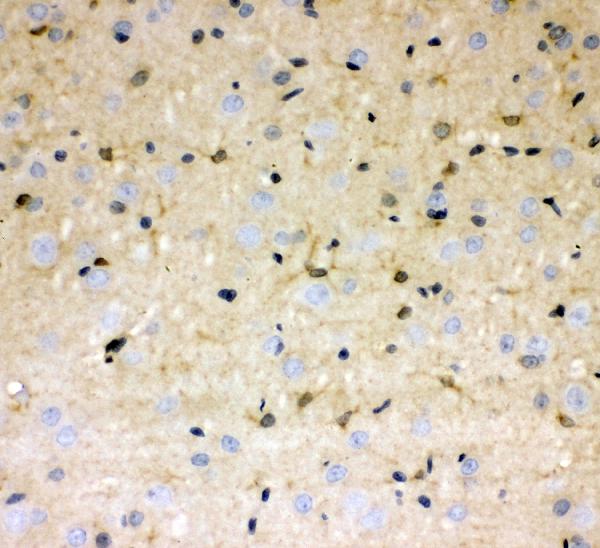 IHC analysis of DDAH1 using anti-DDAH1 antibody (PB10000). DDAH1 was detected in paraffin-embedded section of rat brain tissues. Heat mediated antigen retrieval was performed in citrate buffer (pH6, epitope retrieval solution) for 20 mins. The tissue section was blocked with 10% goat serum. The tissue section was then incubated with 1μg/ml rabbit anti-DDAH1 Antibody (PB10000) overnight at 4°C. Biotinylated goat anti-rabbit IgG was used as secondary antibody and incubated for 30 minutes at 37°C. The tissue section was developed using Strepavidin-Biotin-Complex (SABC)(Catalog # SA1022) with DAB as the chromogen.