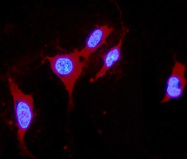 IF analysis of DDAH1 using anti-DDAH1 antibody (PB10000).