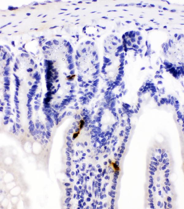 IHC analysis of Peptide YY using anti-Peptide YY antibody (PB10014). Peptide YY was detected in paraffin-embedded section of mouse intestine tissues. Heat mediated antigen retrieval was performed in citrate buffer (pH6, epitope retrieval solution) for 20 mins. The tissue section was blocked with 10% goat serum. The tissue section was then incubated with 1μg/ml rabbit anti-Peptide YY Antibody (PB10014) overnight at 4°C. Biotinylated goat anti-rabbit IgG was used as secondary antibody and incubated for 30 minutes at 37°C. The tissue section was developed using Strepavidin-Biotin-Complex (SABC)(Catalog # SA1022) with DAB as the chromogen.