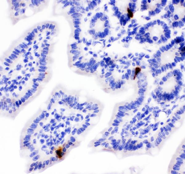 IHC analysis of Peptide YY using anti-Peptide YY antibody (PB10014). Peptide YY was detected in paraffin-embedded section of mouse intestine tissues. Heat mediated antigen retrieval was performed in citrate buffer (pH6, epitope retrieval solution) for 20 mins. The tissue section was blocked with 10% goat serum. The tissue section was then incubated with 1μg/ml rabbit anti-Peptide YY Antibody (PB10014) overnight at 4°C. Biotinylated goat anti-rabbit IgG was used as secondary antibody and incubated for 30 minutes at 37°C. The tissue section was developed using Strepavidin-Biotin-Complex (SABC)(Catalog # SA1022) with DAB as the chromogen.