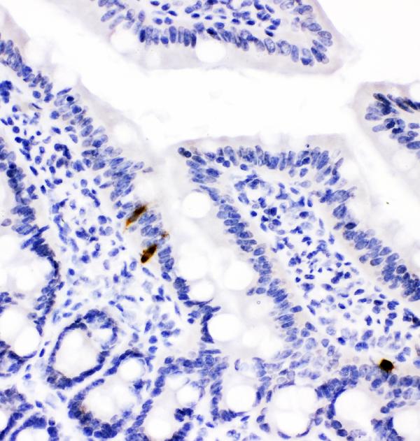 IHC analysis of Peptide YY using anti-Peptide YY antibody (PB10014). Peptide YY was detected in paraffin-embedded section of rat intestine tissues. Heat mediated antigen retrieval was performed in citrate buffer (pH6, epitope retrieval solution) for 20 mins. The tissue section was blocked with 10% goat serum. The tissue section was then incubated with 1μg/ml rabbit anti-Peptide YY Antibody (PB10014) overnight at 4°C. Biotinylated goat anti-rabbit IgG was used as secondary antibody and incubated for 30 minutes at 37°C. The tissue section was developed using Strepavidin-Biotin-Complex (SABC)(Catalog # SA1022) with DAB as the chromogen.