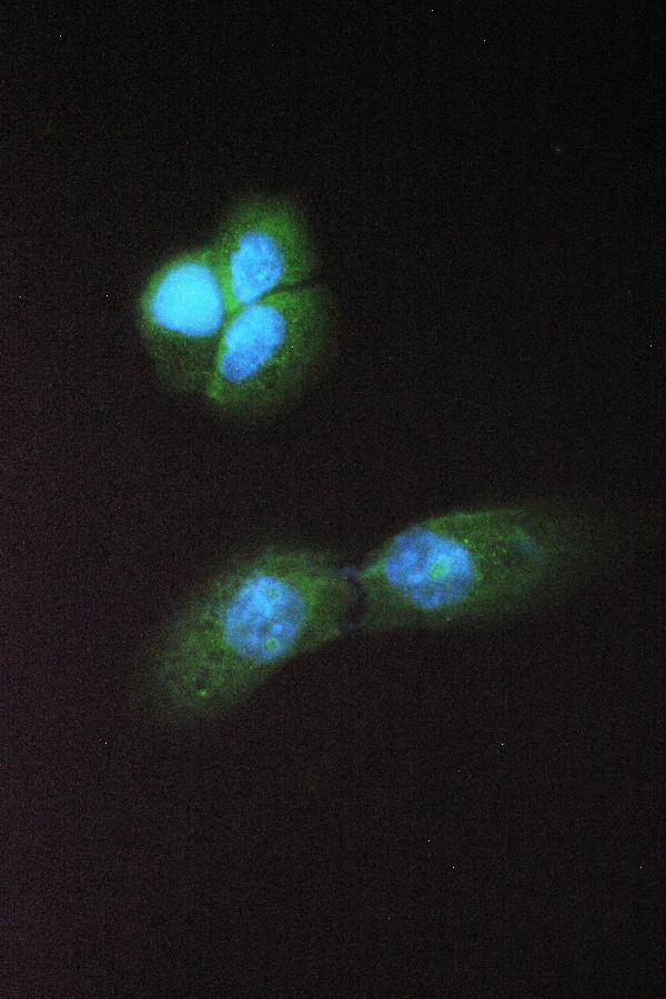 IF analysis of Abhd5 using anti-Abhd5 antibody (PB10021). Abhd5 was detected in immunocytochemical section of A431 cell. Enzyme antigen retrieval was performed using IHC enzyme antigen retrieval reagent (AR0022) for 15 mins. The cells were blocked with 10% goat serum. And then incubated with 2μg/mL rabbit anti-Abhd5 Antibody ((PB10021) overnight at 4°C. DyLight®488 Conjugated Goat Anti-Rabbit IgG (BA1127) was used as secondary antibody at 1:100 dilution and incubated for 30 minutes at 37°C. The section was counterstained with DAPI. Visualize using a fluorescence microscope and filter sets appropriate for the label used.