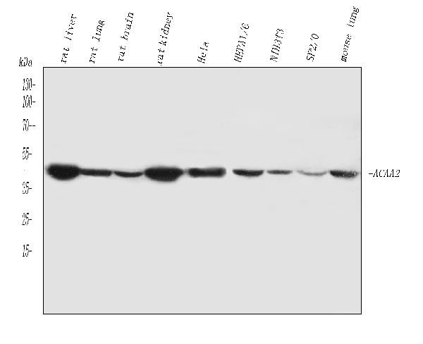 Western blot analysis of ACAA2 using anti-ACAA2 antibody (PB10022).